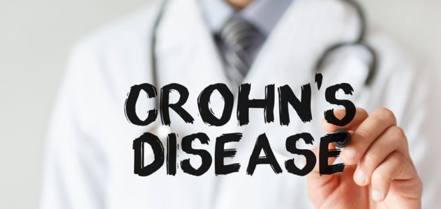 Malattia di Crohn, ok Aifa a rimborsabilità in Italia di upadacitinib