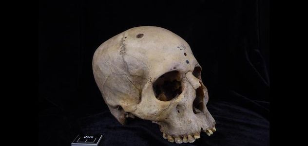 Ricerca, su cranio egiziano di 4mila anni i segni della prima chirurgia anticancro