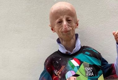 Muore a 28 anni Sammy Basso, il più anziano malato di Progeria