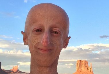 Progeria, cos'è la malattia di cui soffriva Sammy Basso